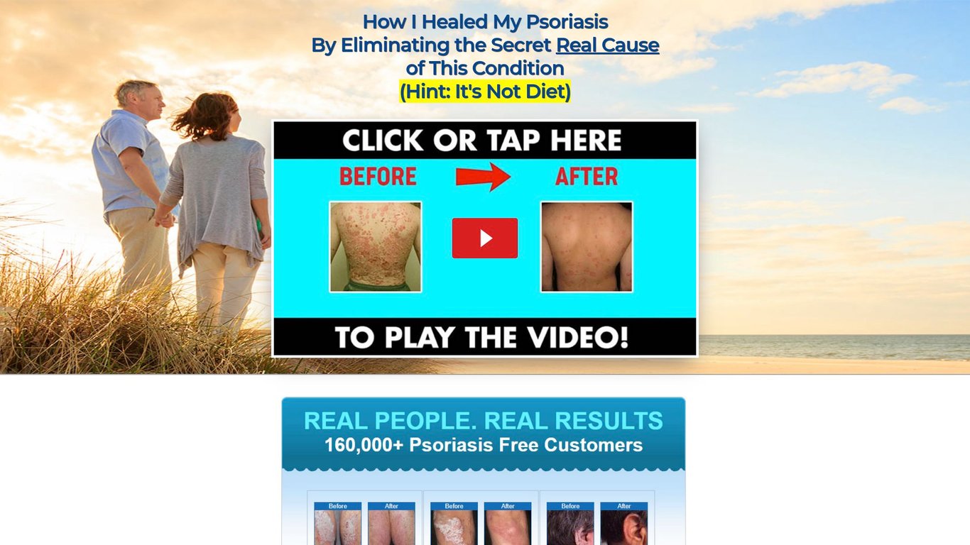 Psoriasis Revolution (TM)~  New Conversion Monster On CB