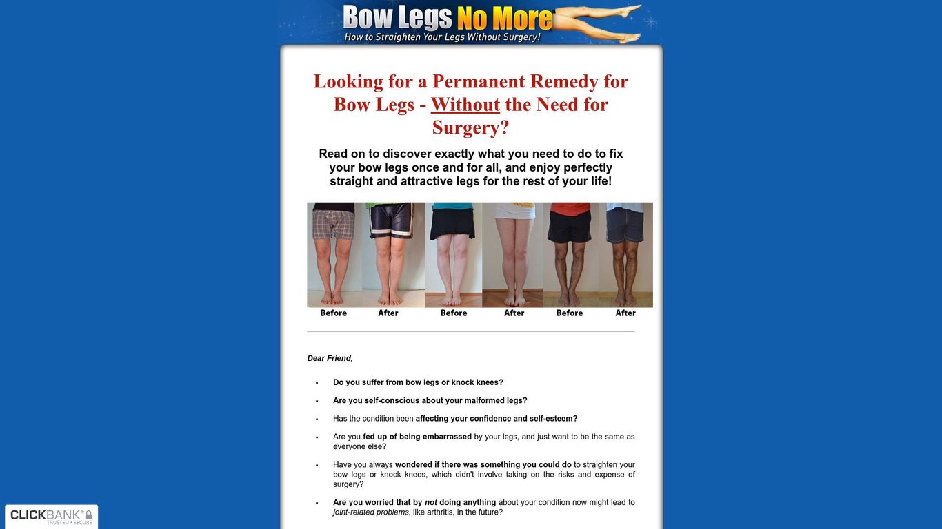 Bow Legs No More - Hot For Year 2020!