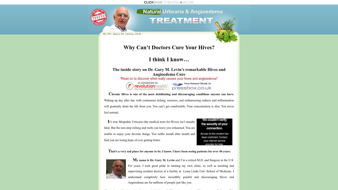 Full Urticaria Cure By Dr Gary M.D